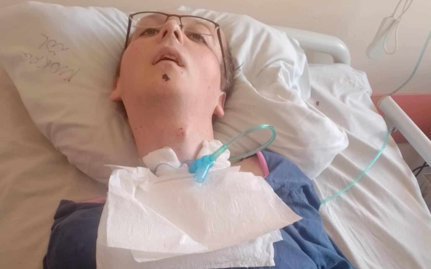 
        Osoba leżąca w szpitalnym łóżku, z rurką do oddychania.
    