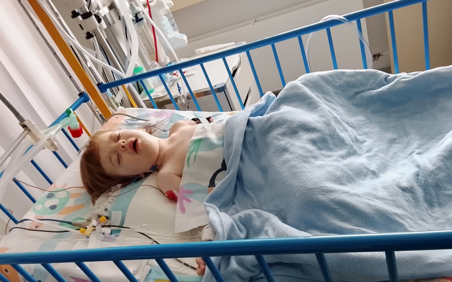 
        Dziecko w szpitalnym łóżku, otoczone sprzętem medycznym.
    