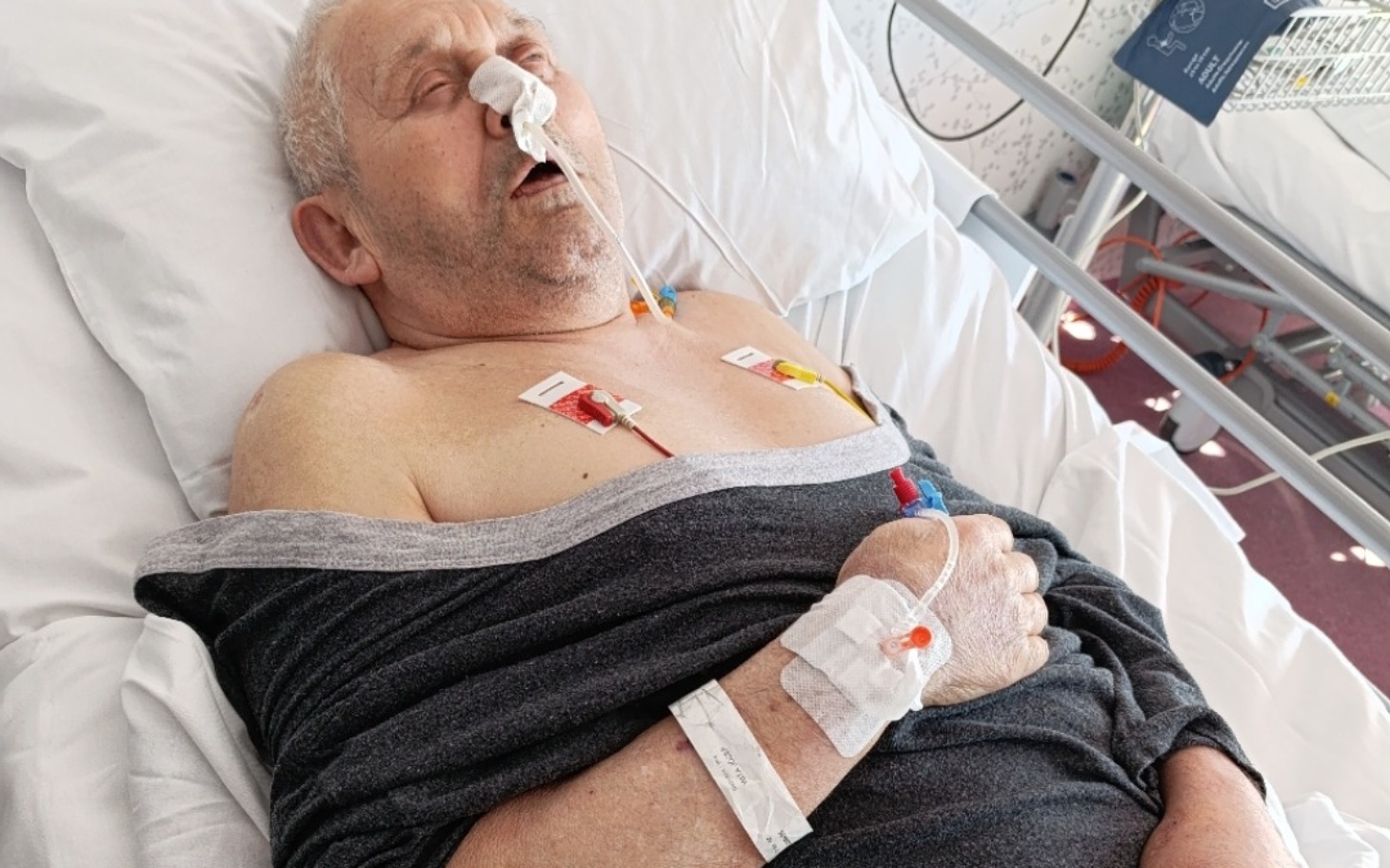
        Mężczyzna w szpitalu, leżący na łóżku z rurkami medycznymi.
    