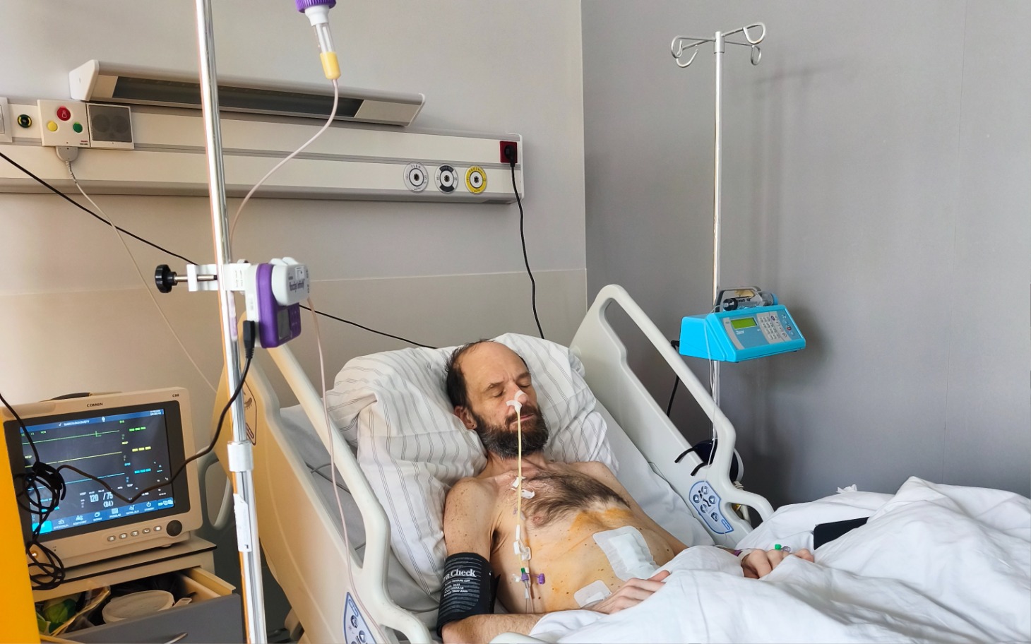 
        Mężczyzna leżący w szpitalnym łóżku, podłączony do aparatury.
    