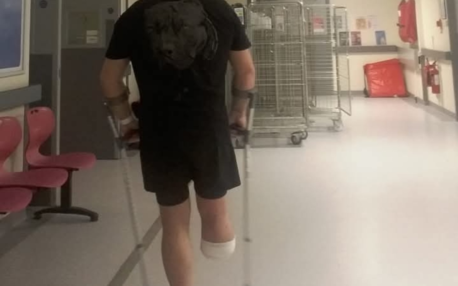 
        Osoba na kulach w szpitalu, z opatrunkiem na nodze.
    