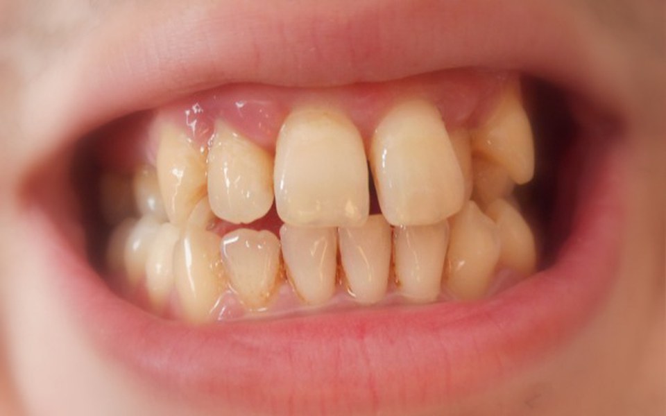 
        Zbiórka Na aparat ortodontyczny - zdjęcie główne
    