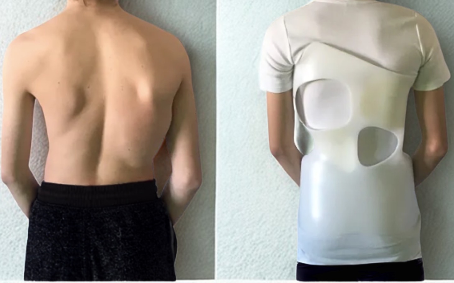 Porównanie pleców przed i po zastosowaniu specjalnej odzieży.