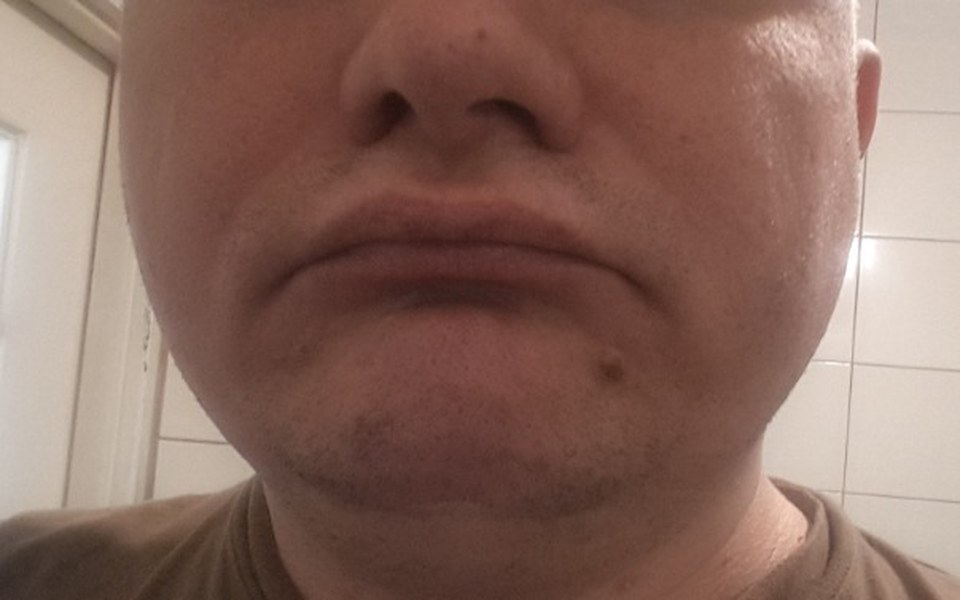 
        Zbiórka Przywróć uśmiech i sens życia - zdjęcie główne
    