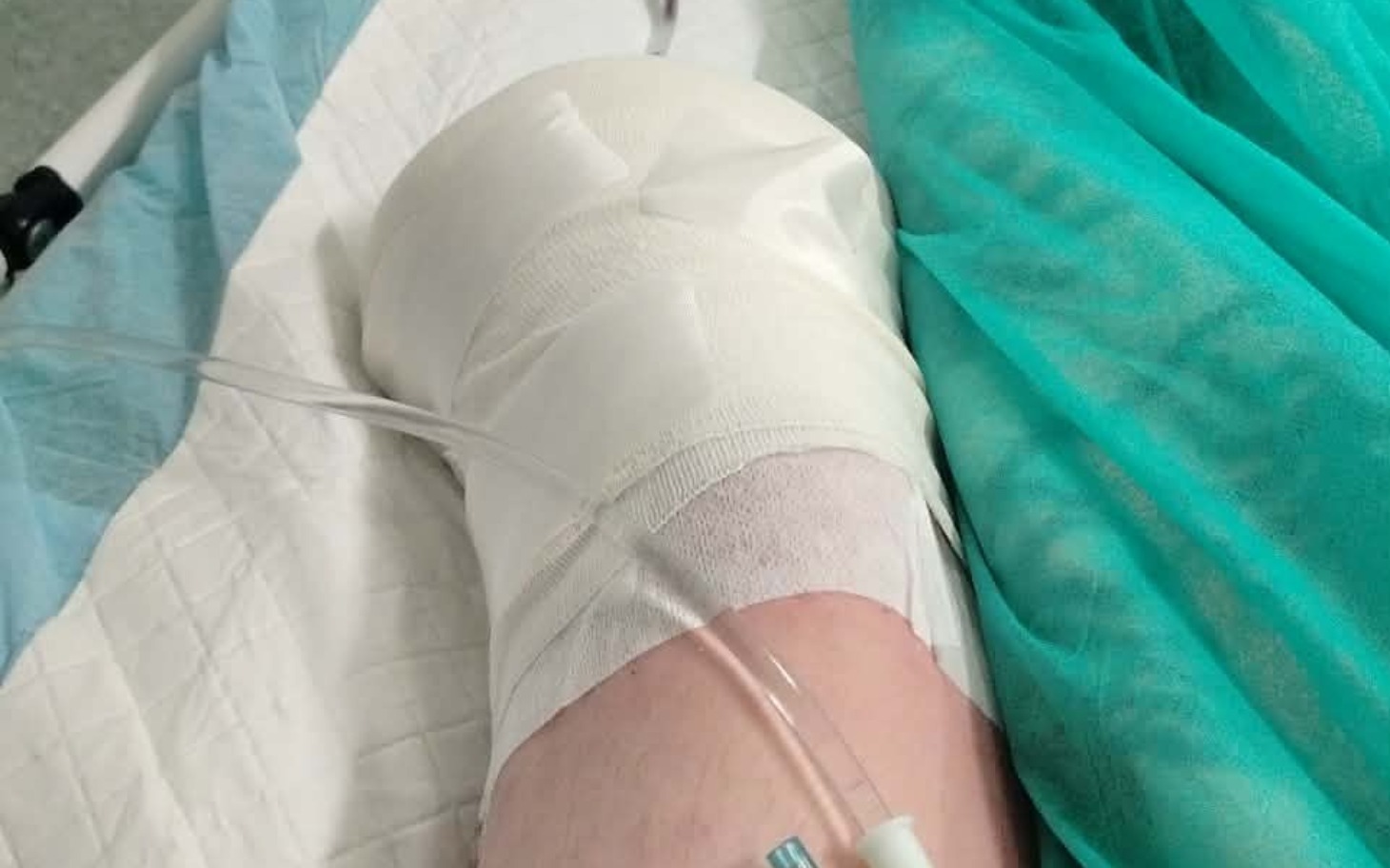 
        Zabandażowana noga pacjenta w szpitalu.
    