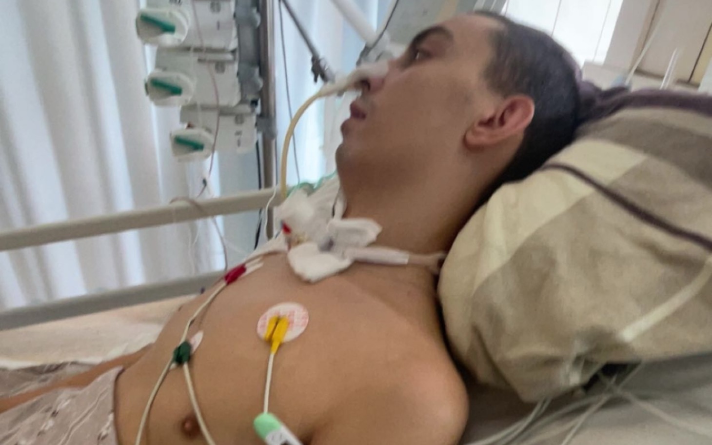 
        Mężczyzna leży w szpitalu, podłączony do aparatury medycznej.
    