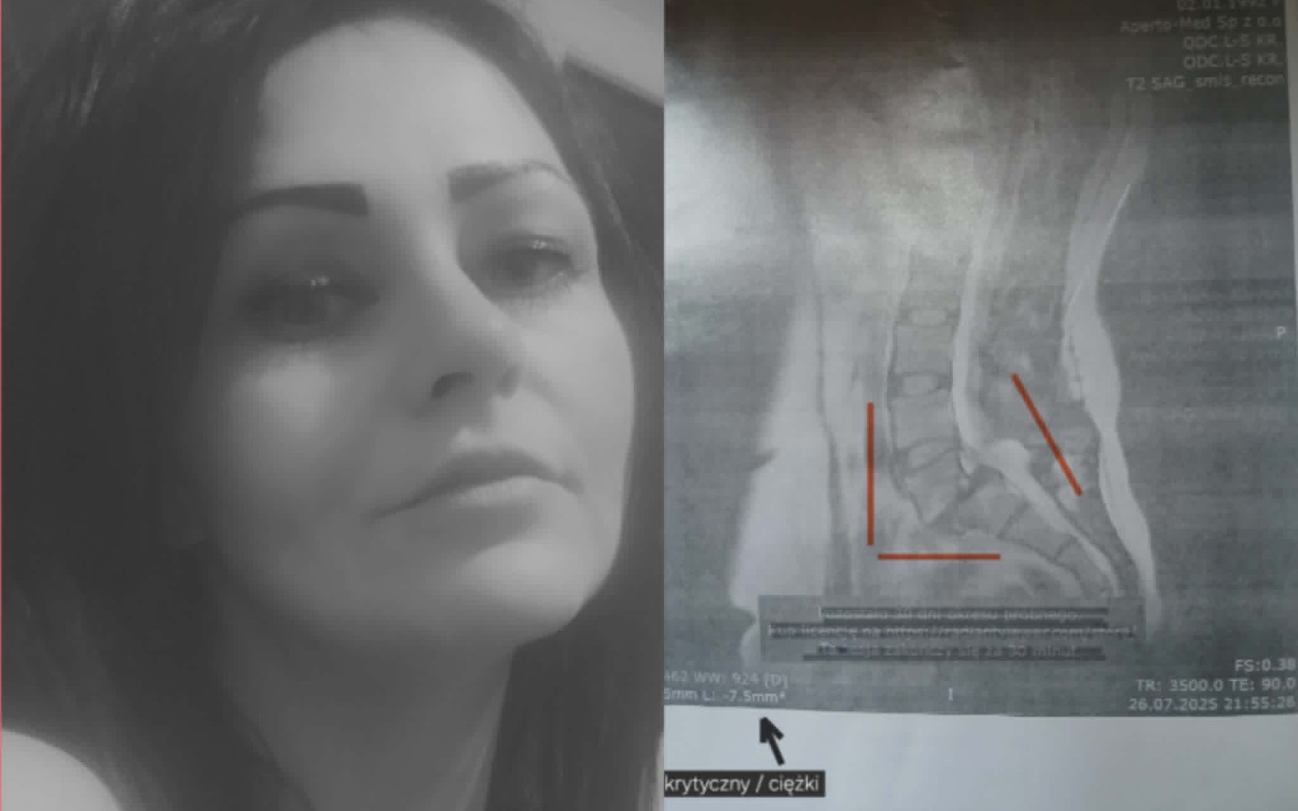 Portret kobiety z konturami na zdjęciu rentgenowskim.