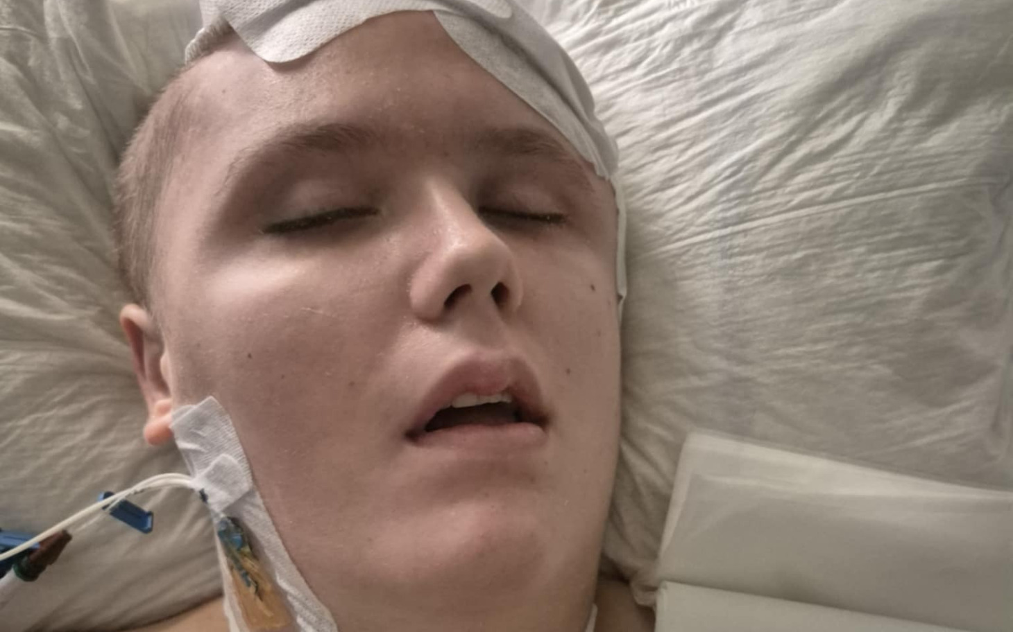 
        Młody chłopak leżący w szpitalu, wygląda na nieprzytomnego.
    