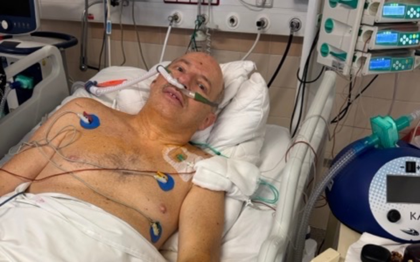 
        Mężczyzna leżący w szpitalu, podłączony do aparatury medycznej.
    