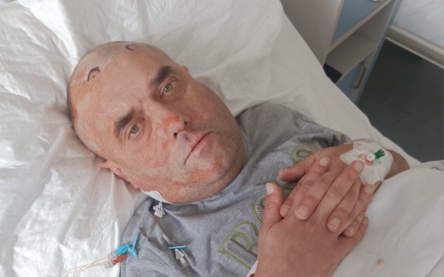 Mężczyzna leżący w szpitalu, z widocznymi śladami po operacji.