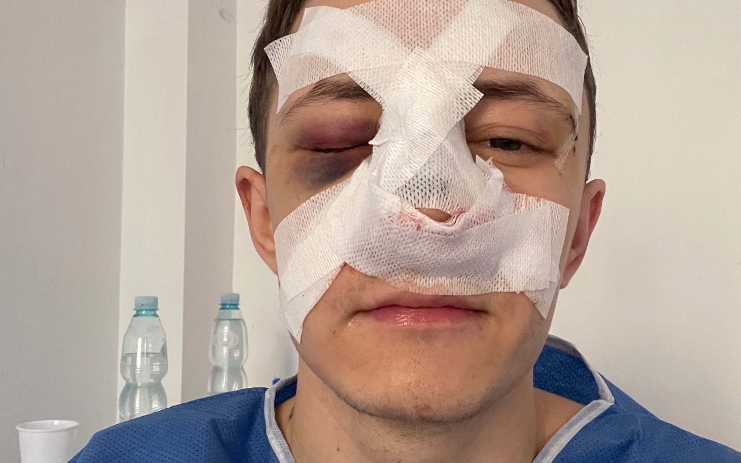 
        Mężczyzna z opatrunkiem na twarzy po urazie.
    