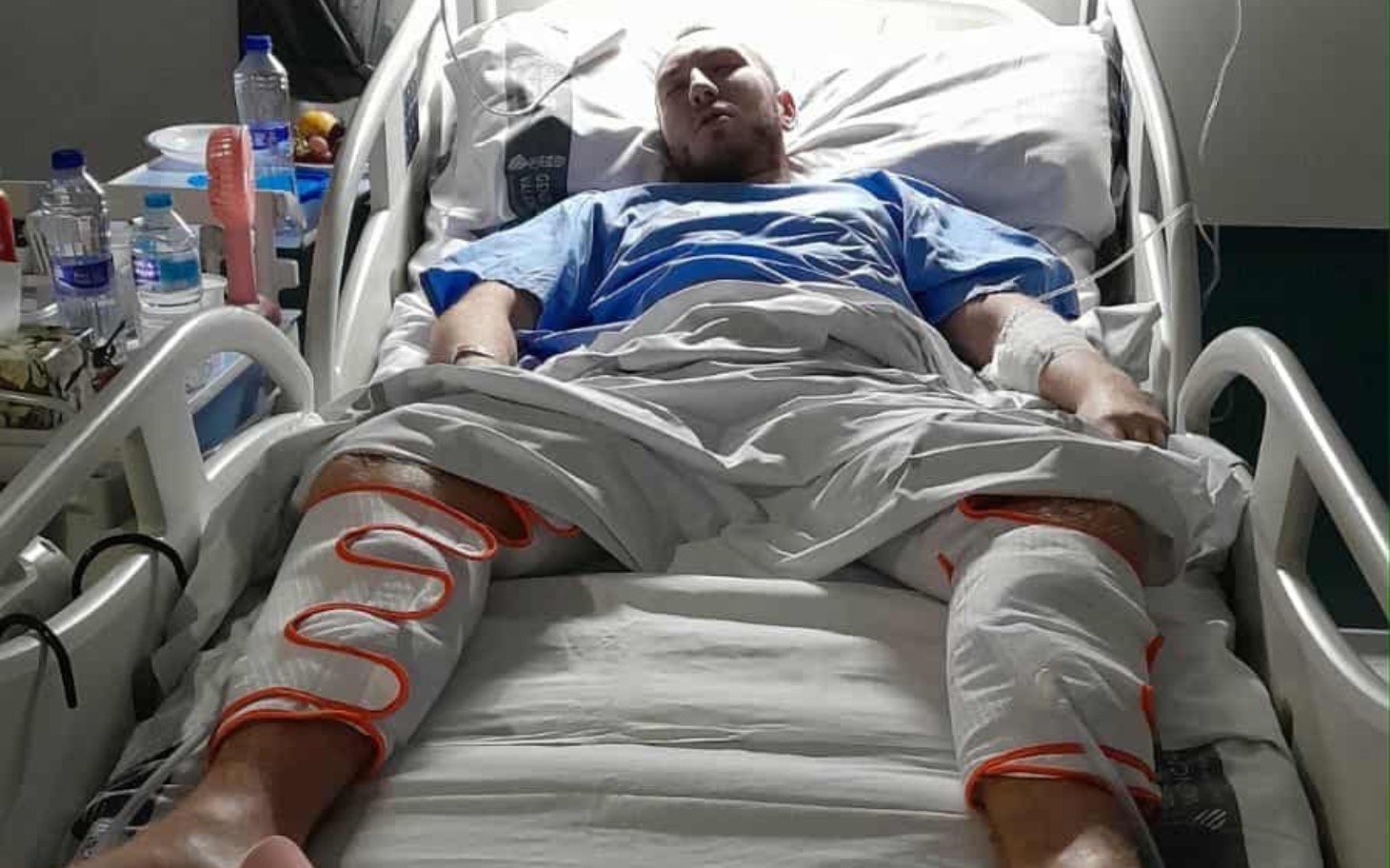 
        Mężczyzna leżący w szpitalnym łóżku, z opatrunkami na nogach.
    