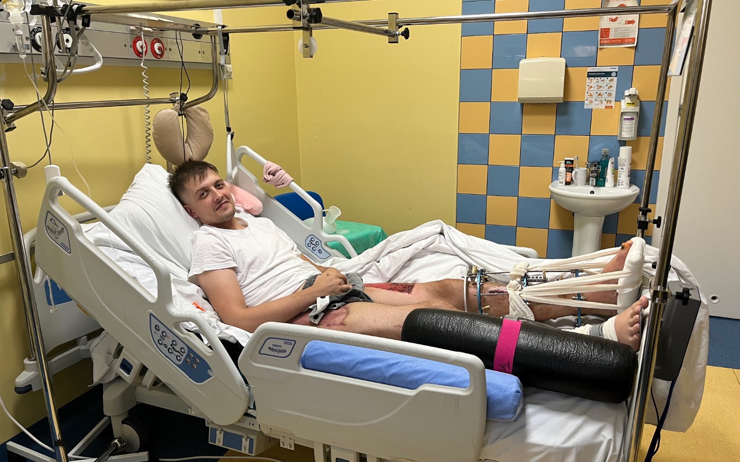 
        Mężczyzna w szpitalnym łóżku po operacji nogi.
    