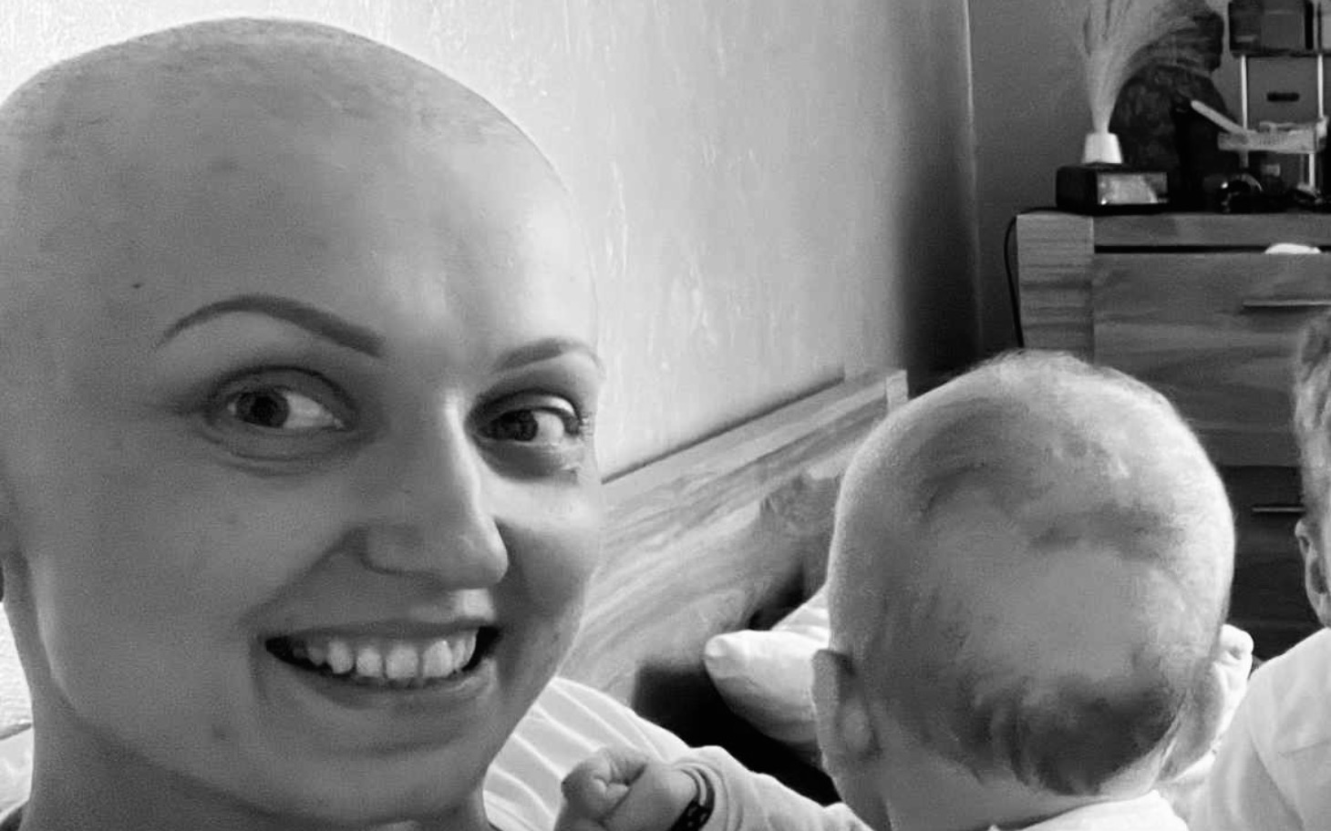 
        Bald woman smiling with a baby, showing love.
    