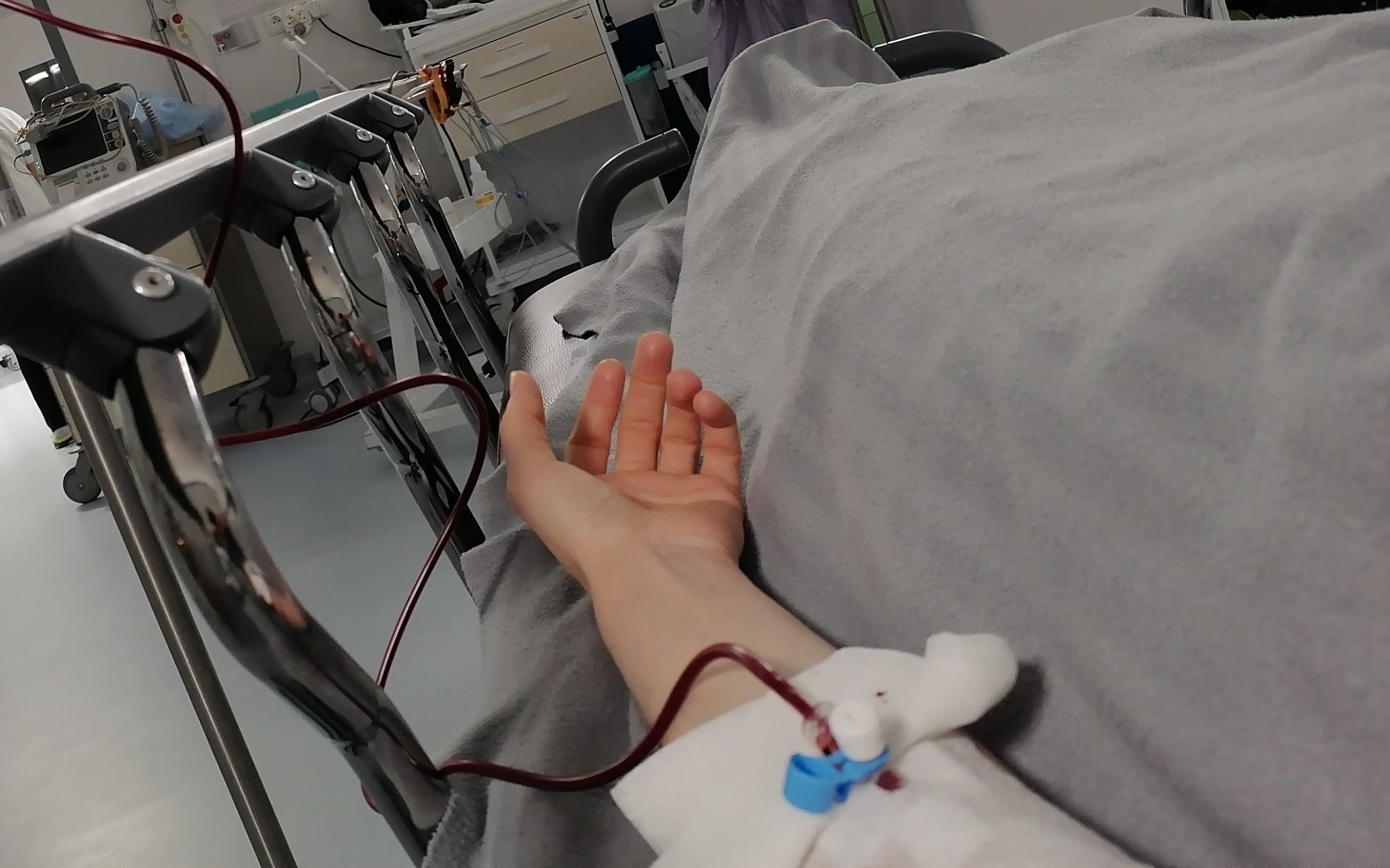 
        Ręka pacjenta z kroplówką w szpitalu.
    