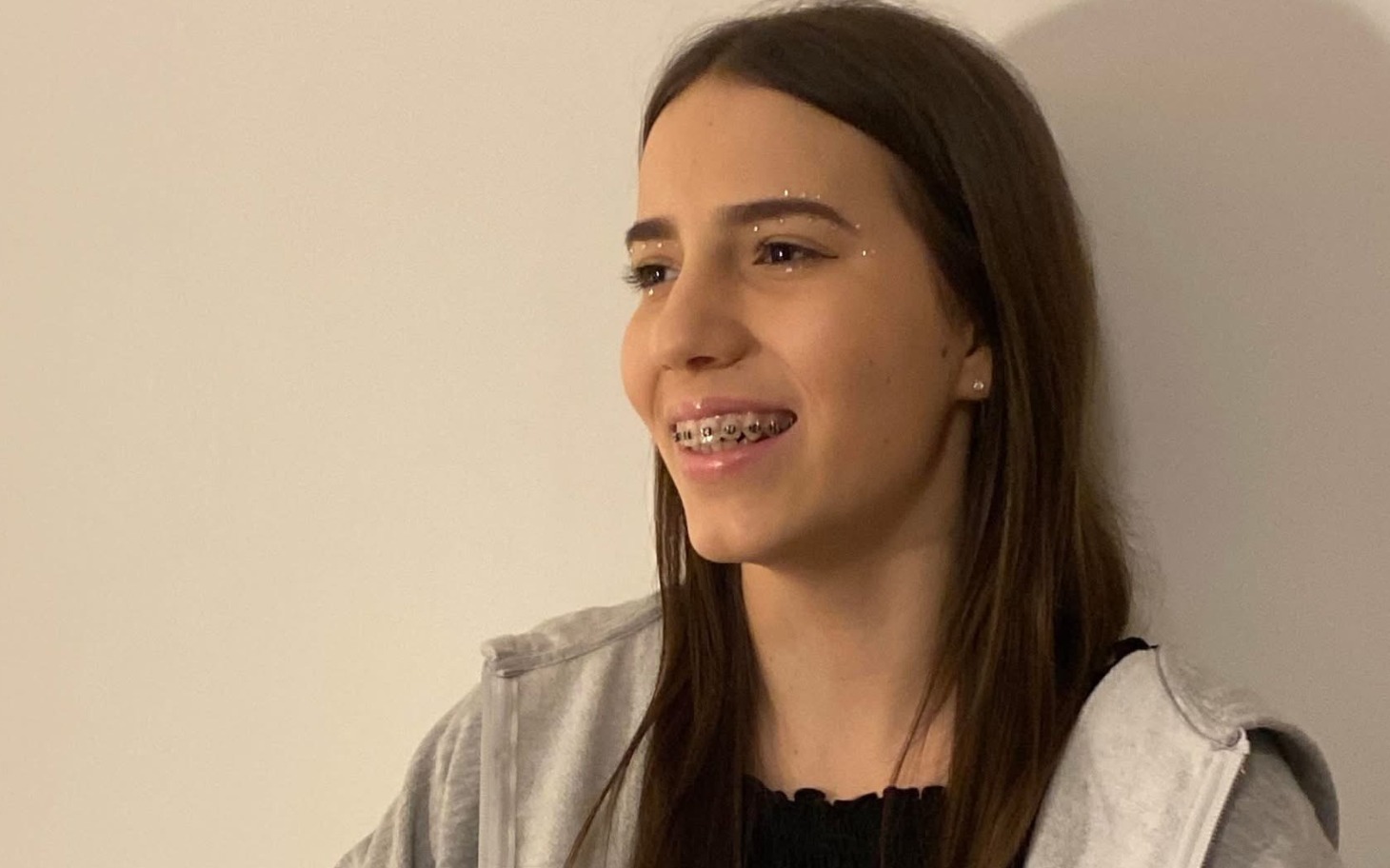 
        Młoda dziewczyna z aparatem na zębach, uśmiechająca się.
    