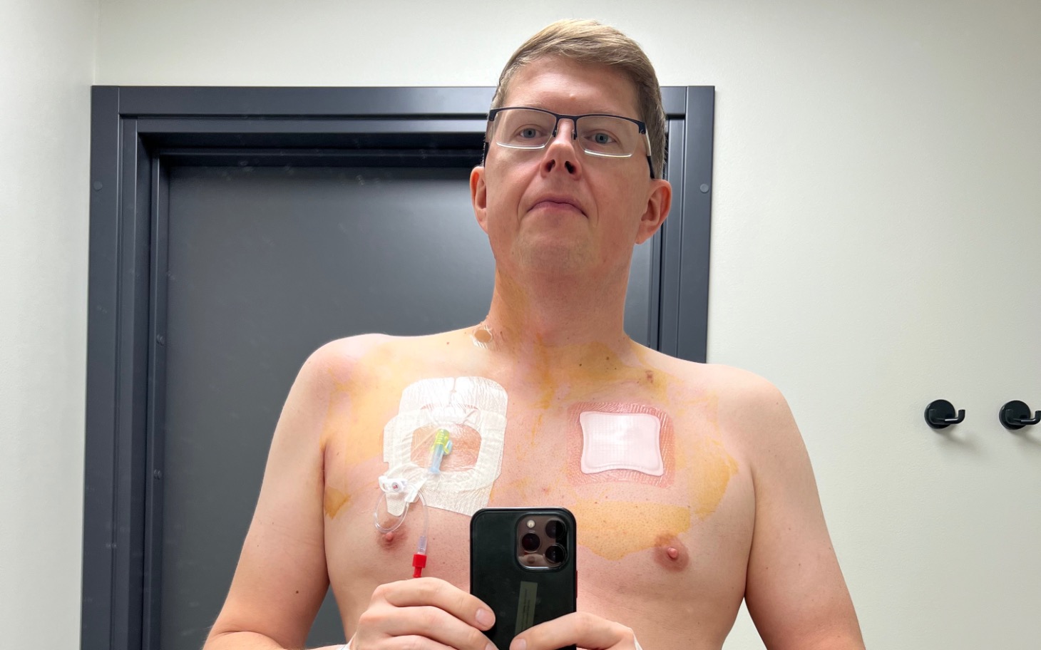 
        Mężczyzna z opatrunkami na klatce piersiowej, trzymający telefon w lustrze.
    