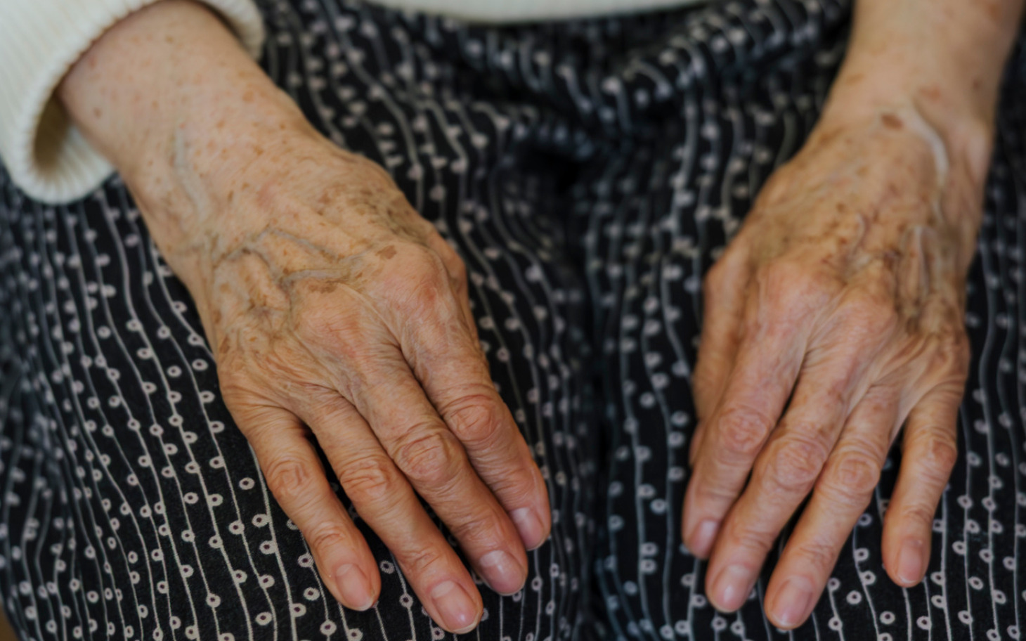 
        Zbliżenie na dłonie starszej osoby, z widocznymi zmarszczkami.
    