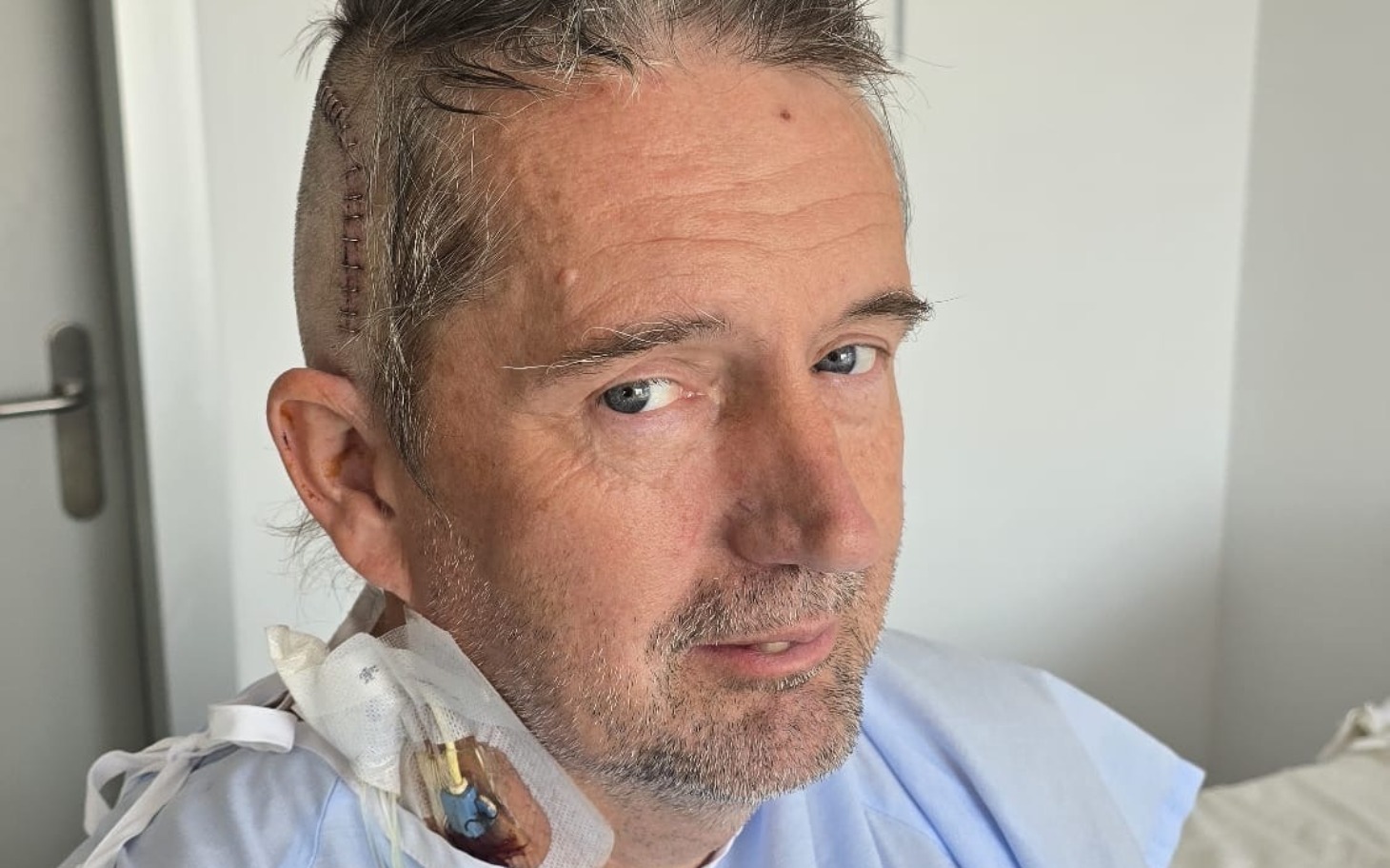 
        Mężczyzna po operacji, z opatrunkiem na szyi.
    