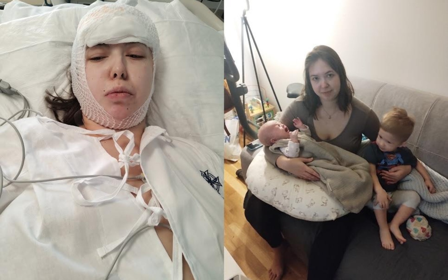 
        Kobieta w szpitalu, po operacji, z opatrunkiem na głowie.
    