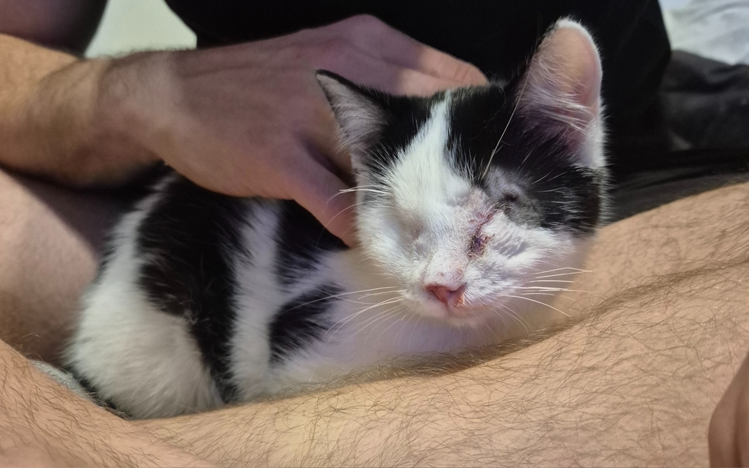 
        Kotek z uszkodzoną powieką na kolanach właściciela.
    