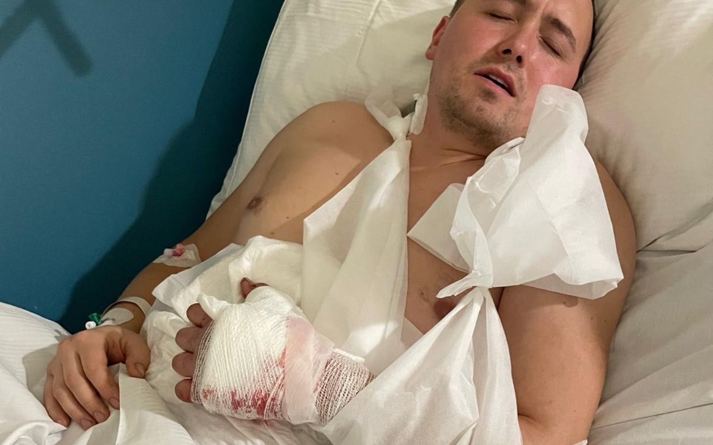 
        Mężczyzna w szpitalnym łóżku, z opatrunkiem na ręce.
    