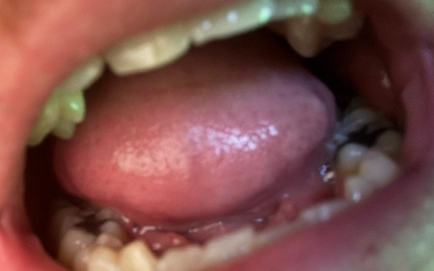 
        Zbliżenie na wnętrze ust z widocznym językiem.
    