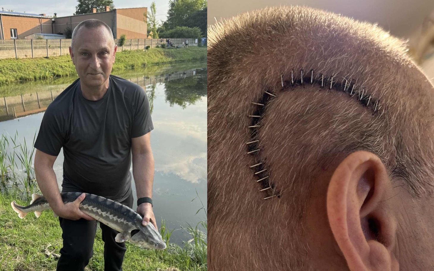 
        Mężczyzna trzymający rybę, z widoczną blizną na głowie.
    