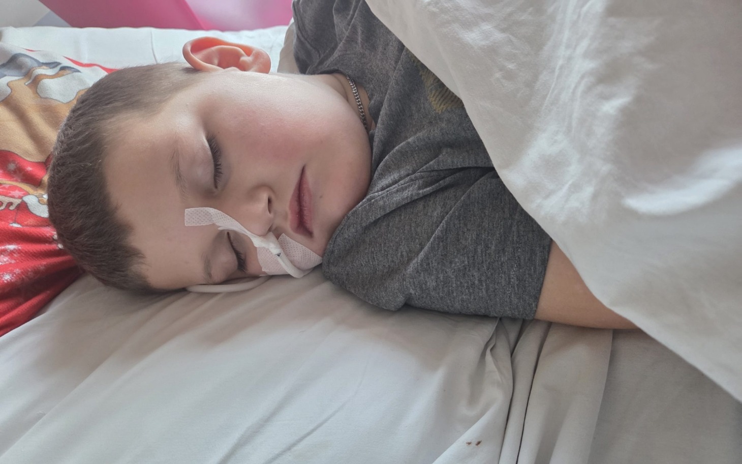 
        Chłopiec śpi w łóżku, z opatrunkiem na nosie.
    