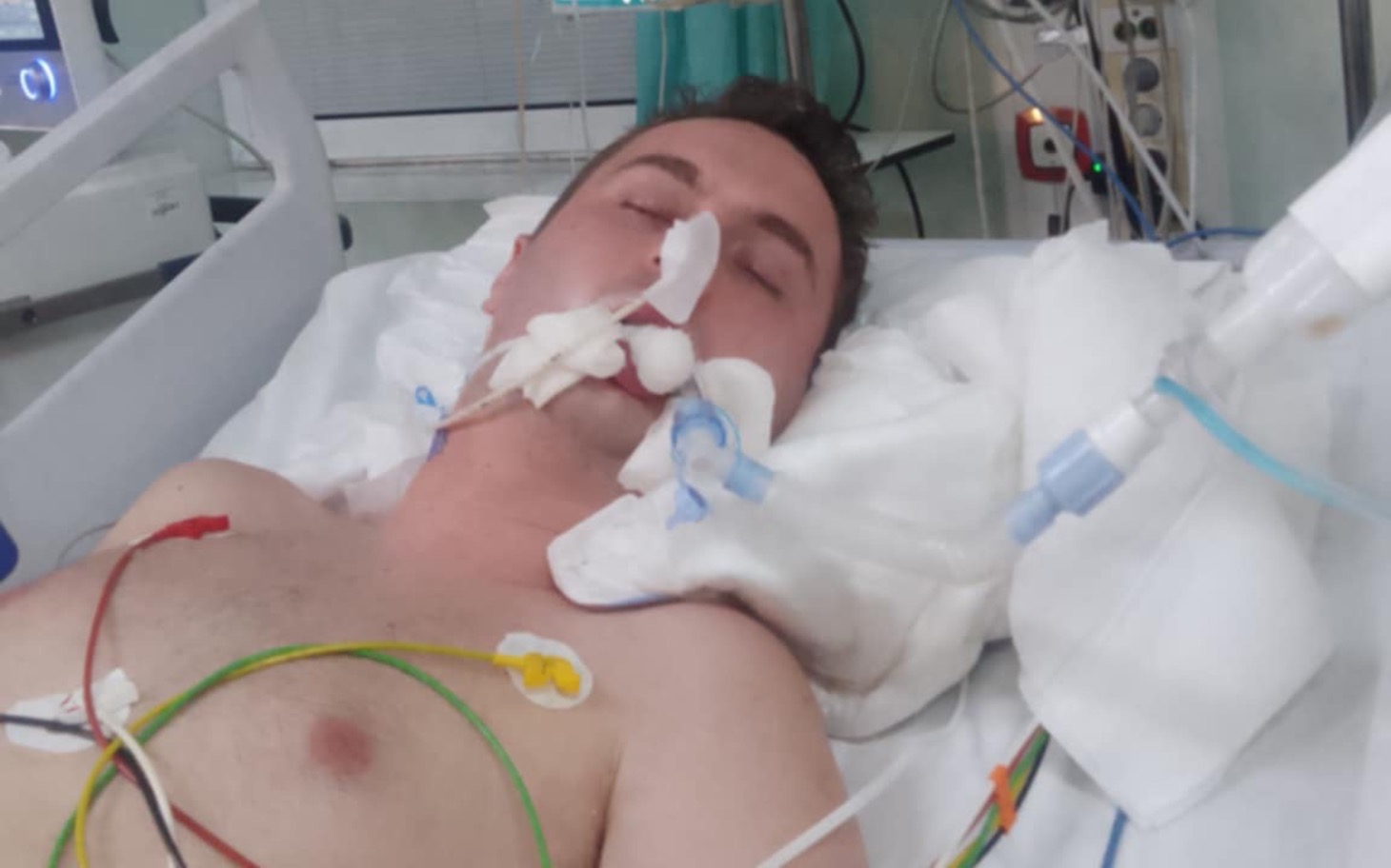 
        Mężczyzna w szpitalu z podłączonymi urządzeniami medycznymi.
    