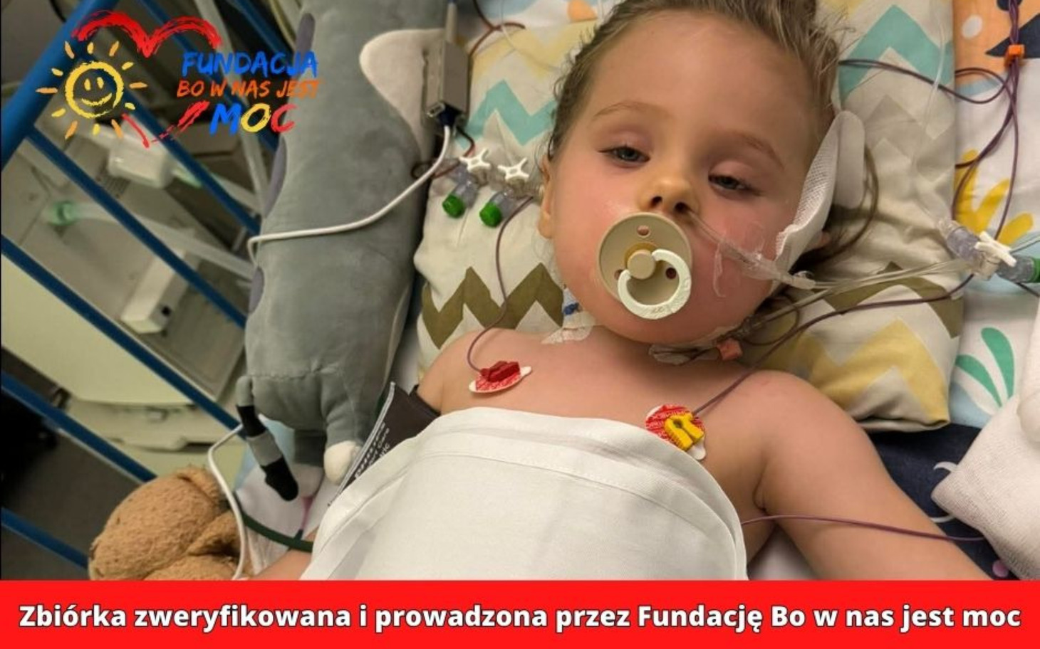 
        Mała dziewczynka w szpitalu, z rurkami i monitorami.
    