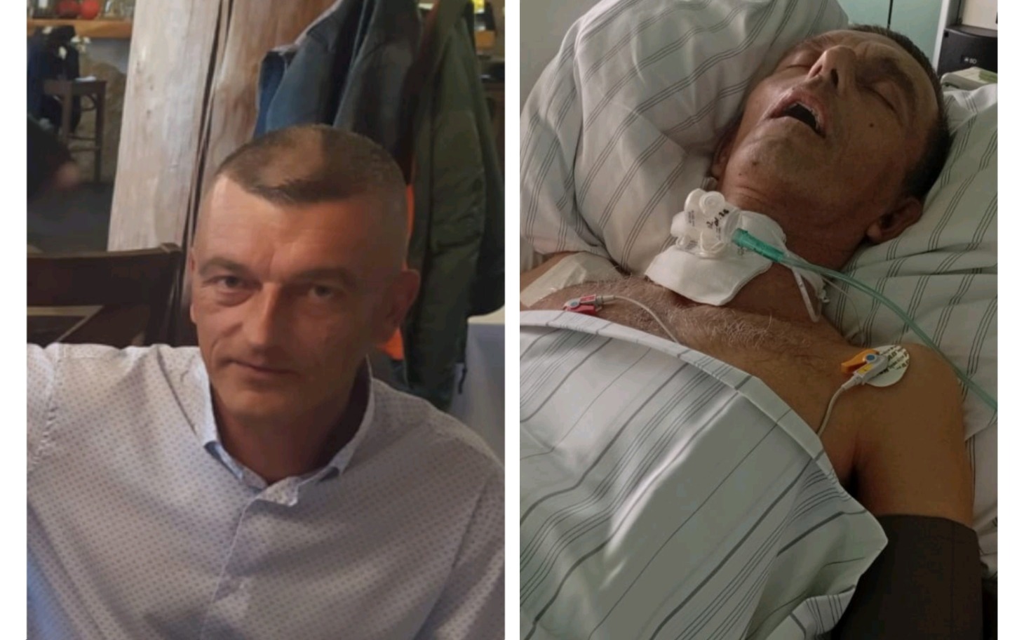 
        Mężczyzna w szpitalu, porównanie przed i po.
    