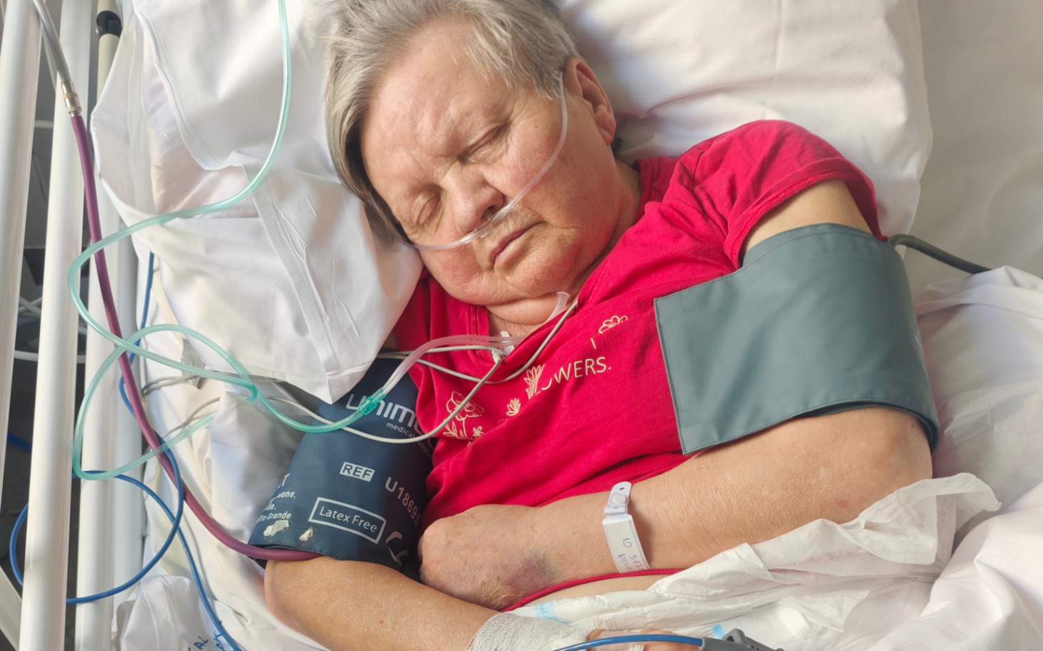 
        Starsza kobieta w szpitalu, śpi z podłączonymi urządzeniami.
    