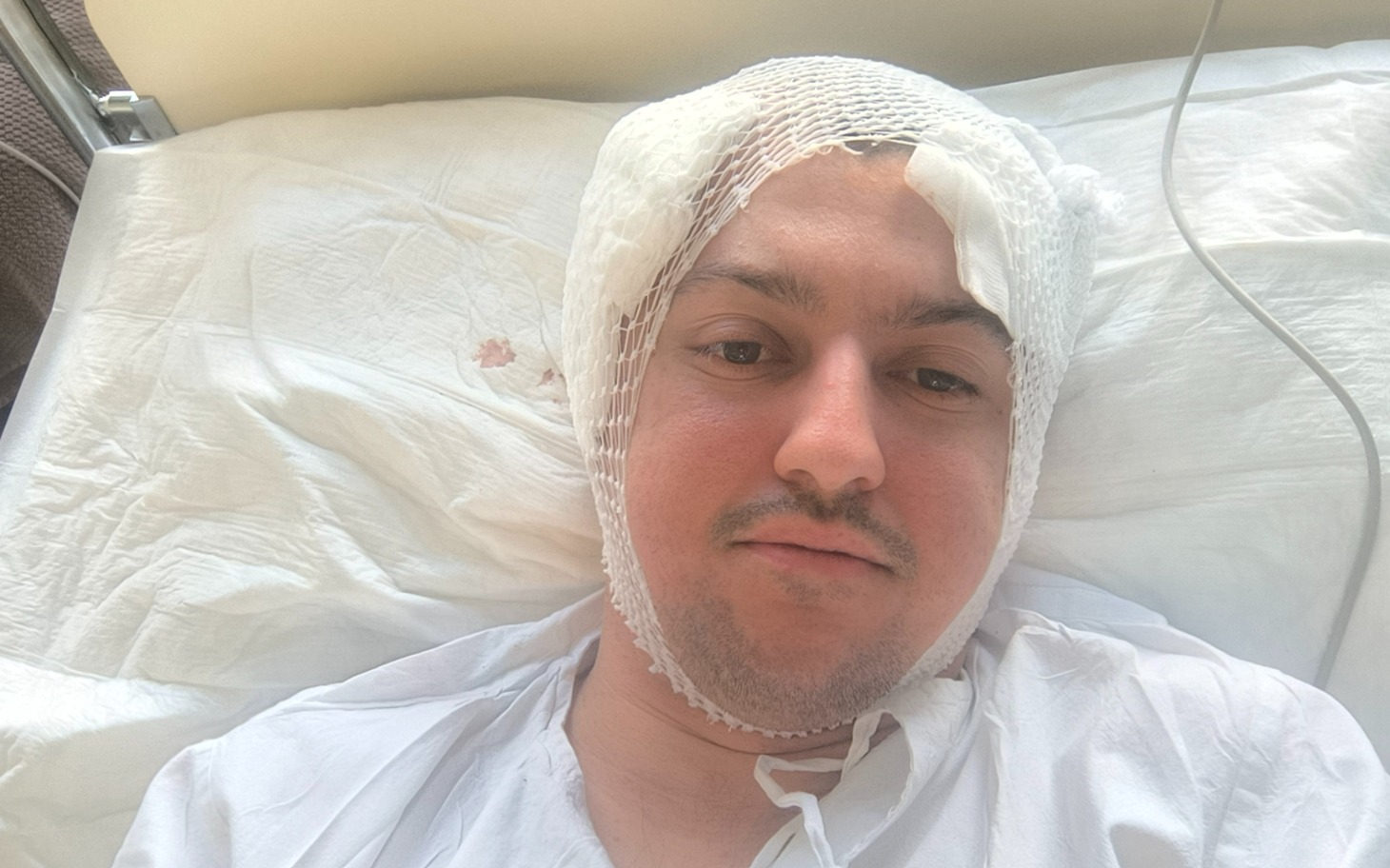 
        Mężczyzna w szpitalnym łóżku, z opatrunkiem na głowie.
    