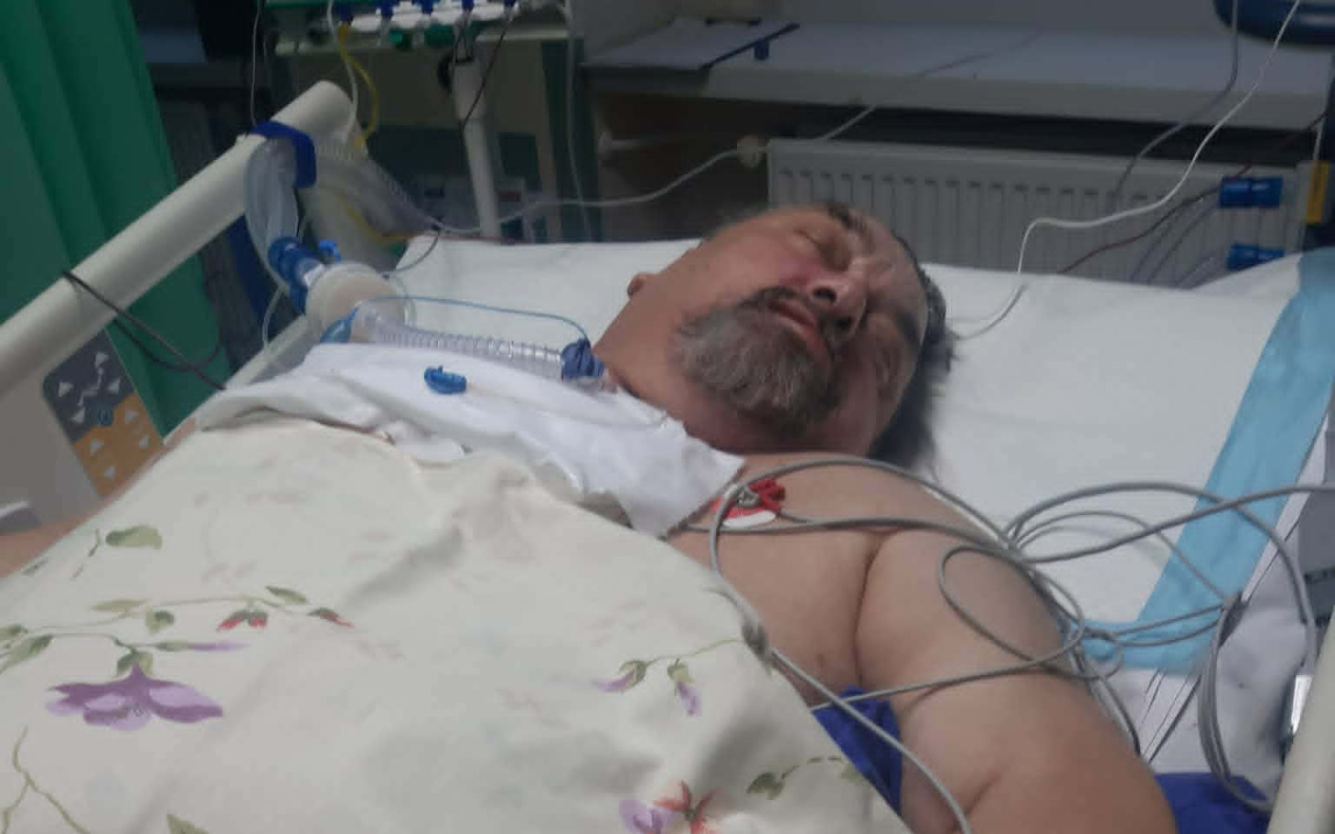 
        Mężczyzna leżący w szpitalu z monitorami medycznymi.
    