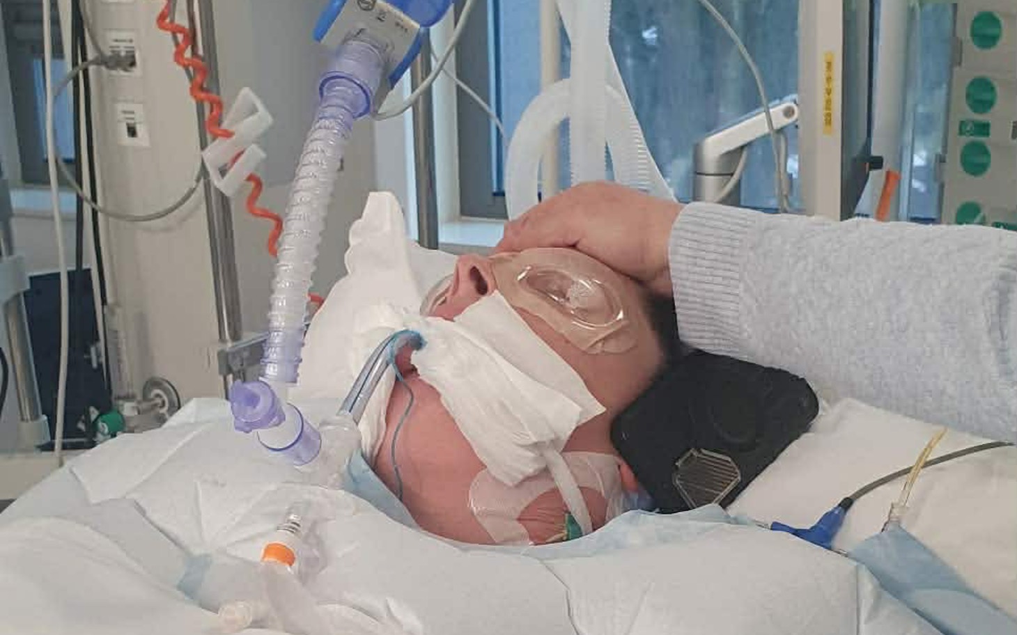 
        Osoba w szpitalu z respiratorem, bliska opieka.
    