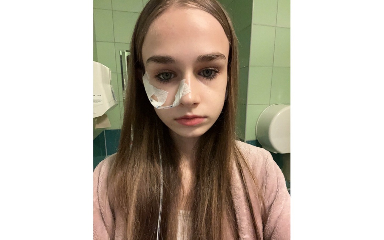 
        Młoda dziewczyna z opatrunkiem na nosie, wygląda na zmartwioną.
    