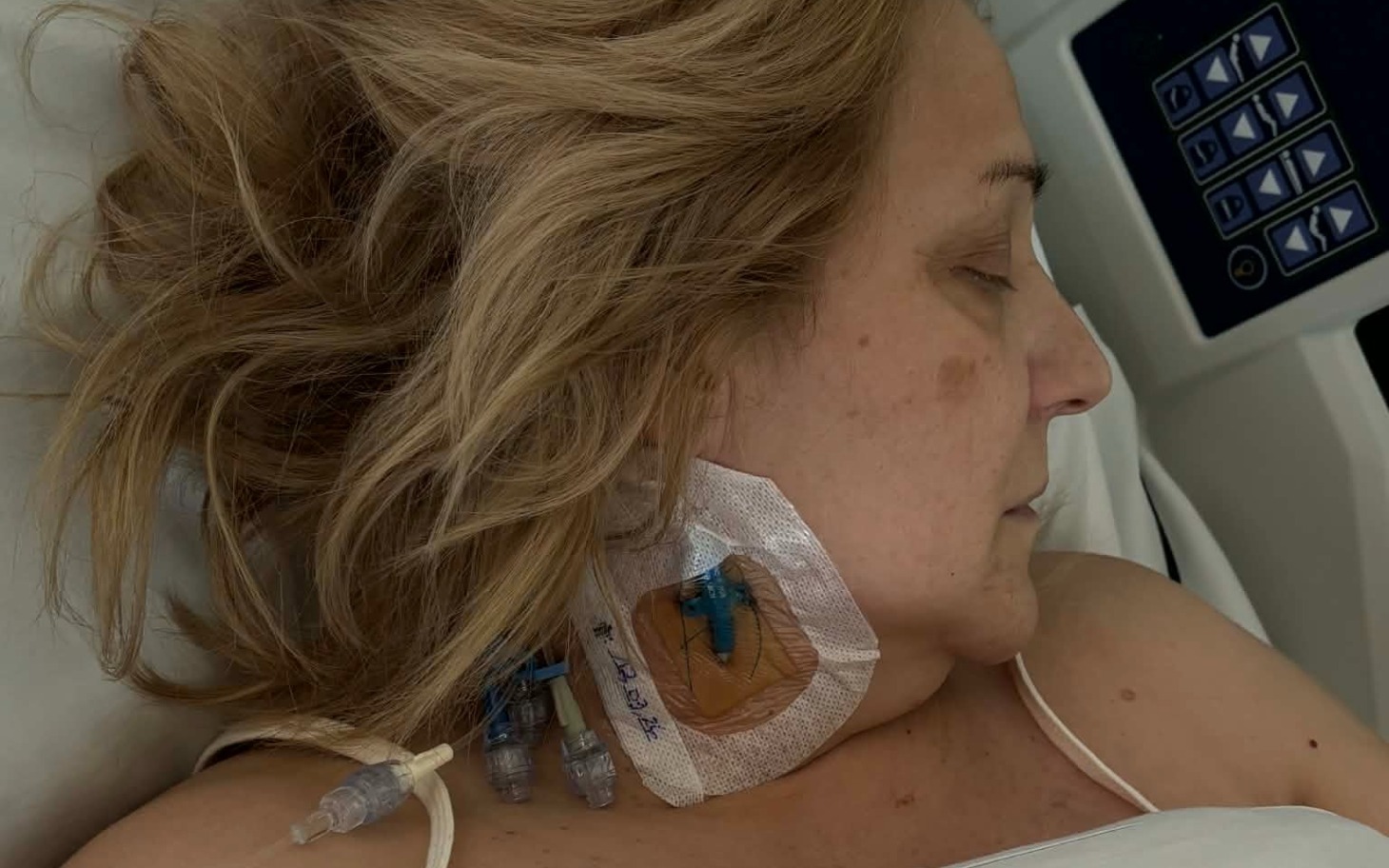 
        Kobieta leżąca w szpitalu, z rurkami przy twarzy.
    