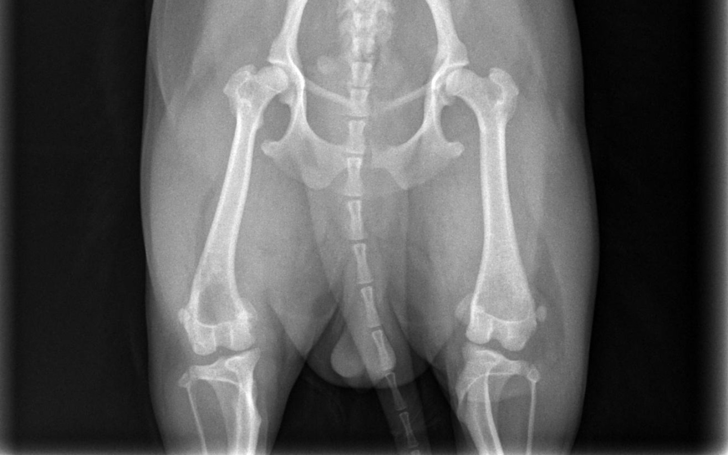 
        Zdjęcie rentgenowskie nóg, ukazujące struktury kostne.
    