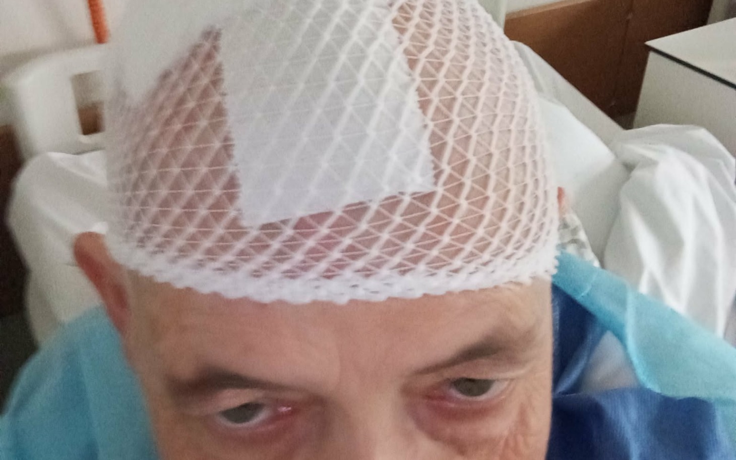
        Pacjent po operacji z opatrunkiem na głowie.
    