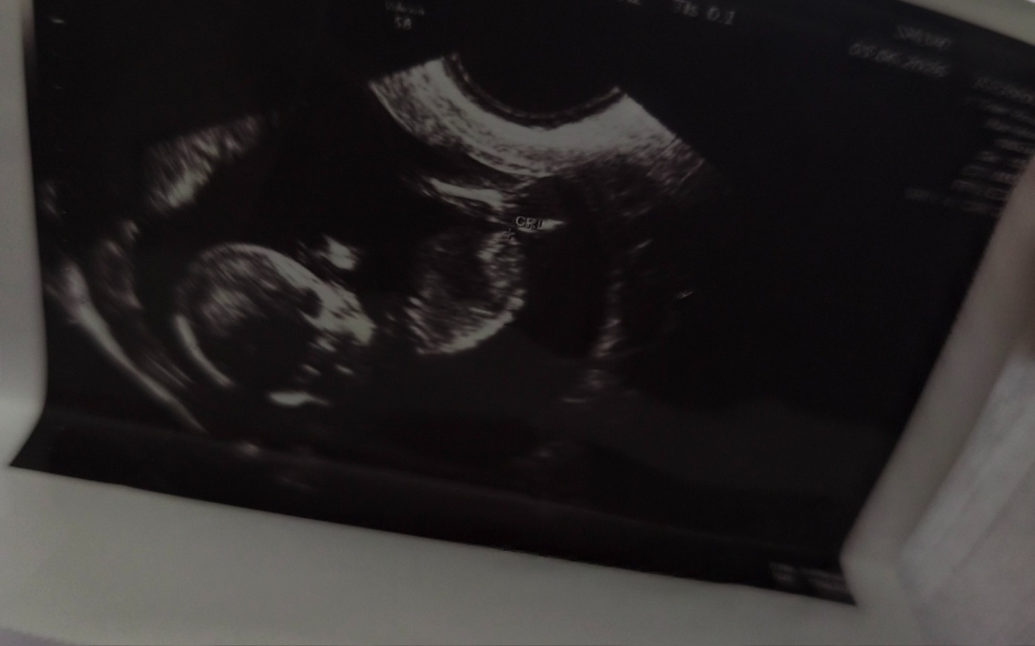 
        Ultrasonografia pokazująca rozwijające się dziecko.
    