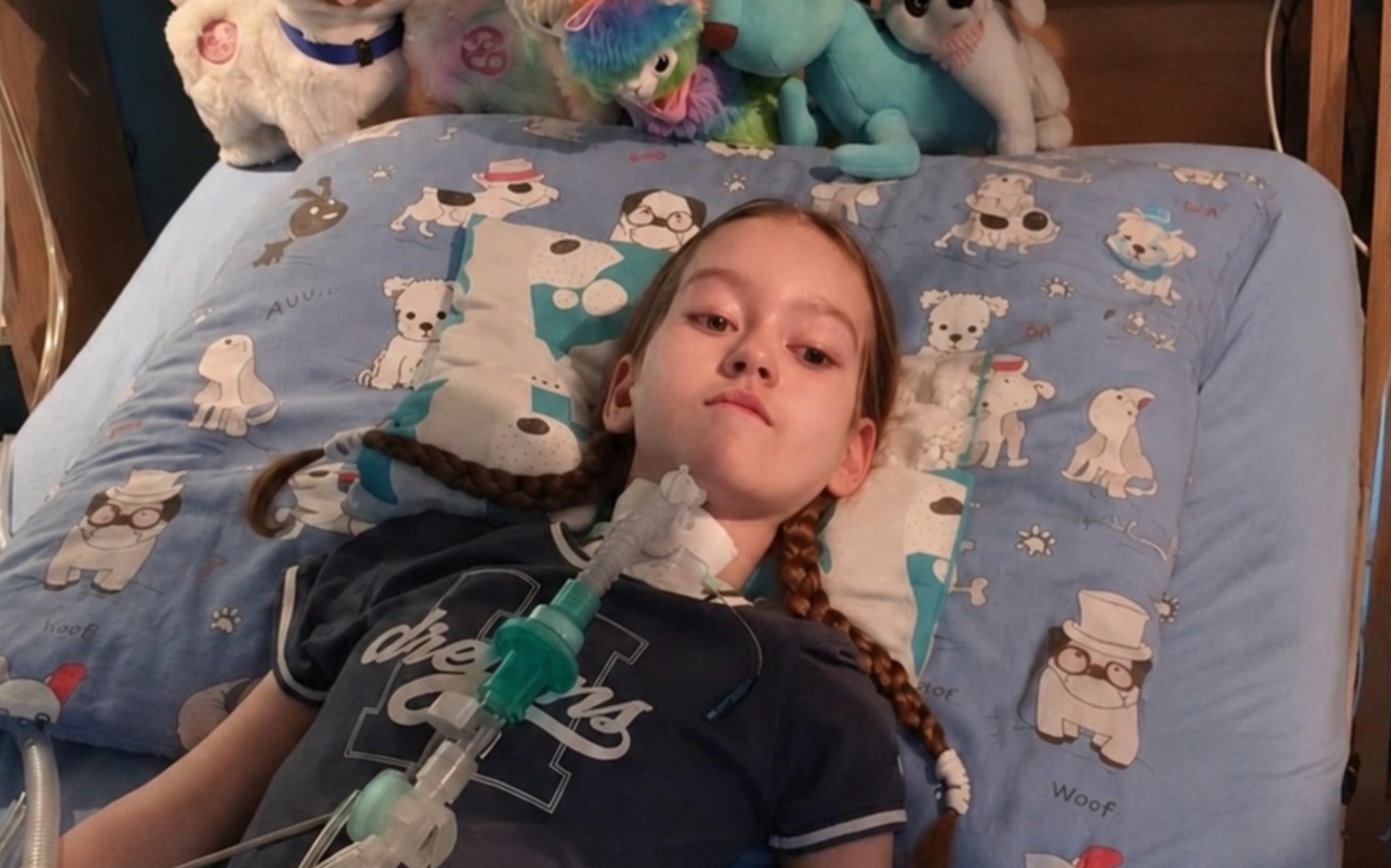 
        Dziewczynka na сепię z respiratorem leżąca w łóżku, otoczenie pluszowe zabawki
    