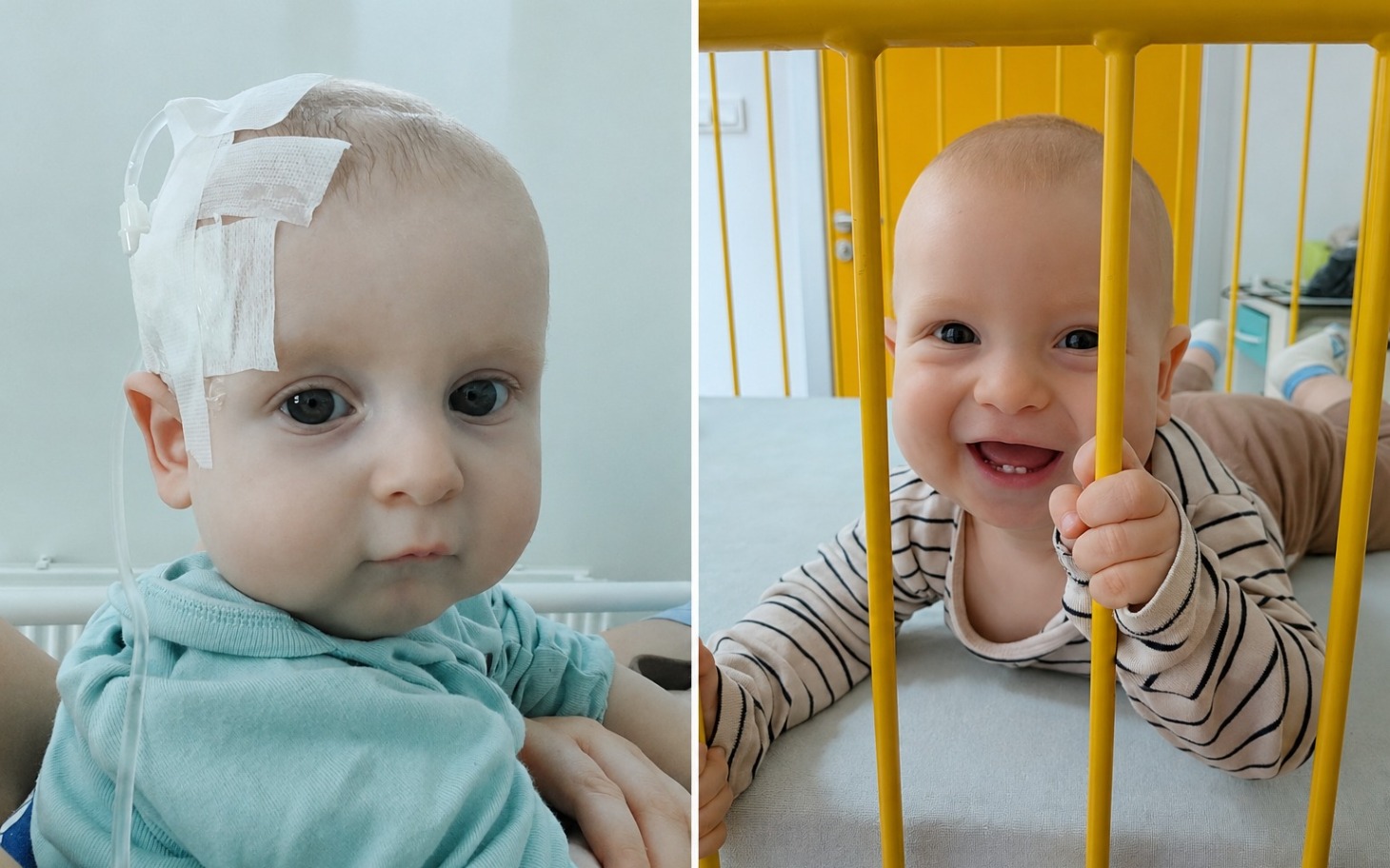 
        Zamglony obraz dzieci w sprzęcie medycznym szpitalnym.
    