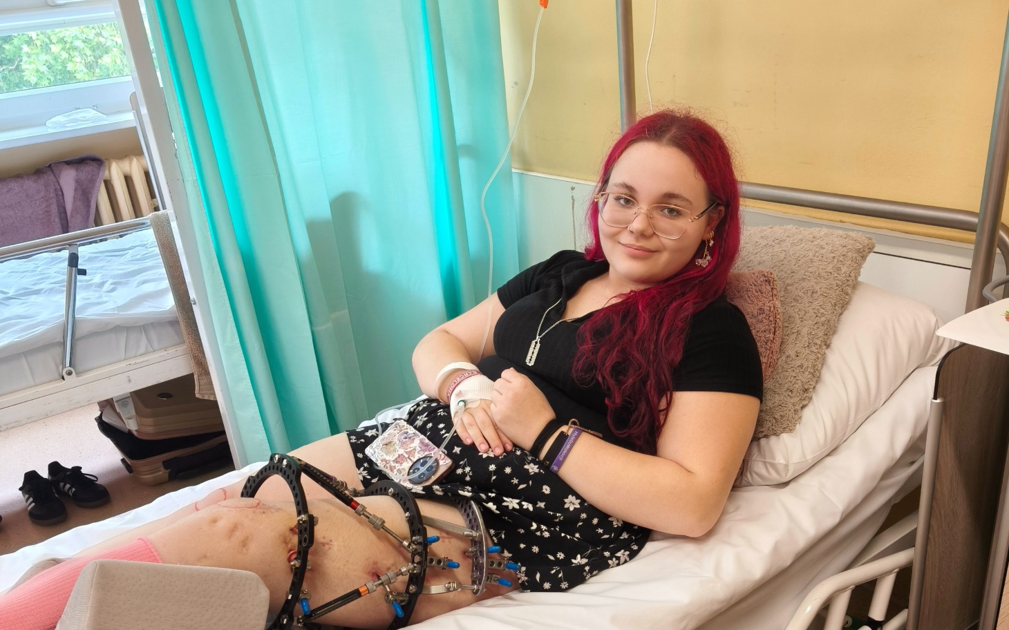 
        Osoba w szpitalnym łóżku z zieloną zasłoną w tle, na nodze opatrunek i opaska
    