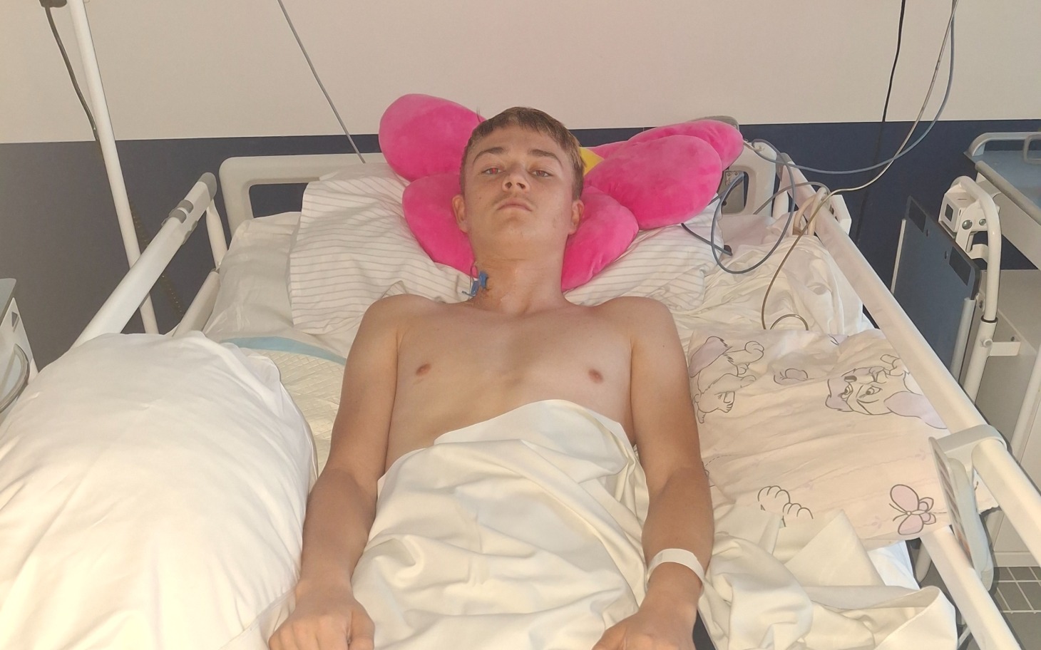 
        Mężczyzna leżący na hospitalizacji z opaską na ramieniu, na białej pościeli.
    