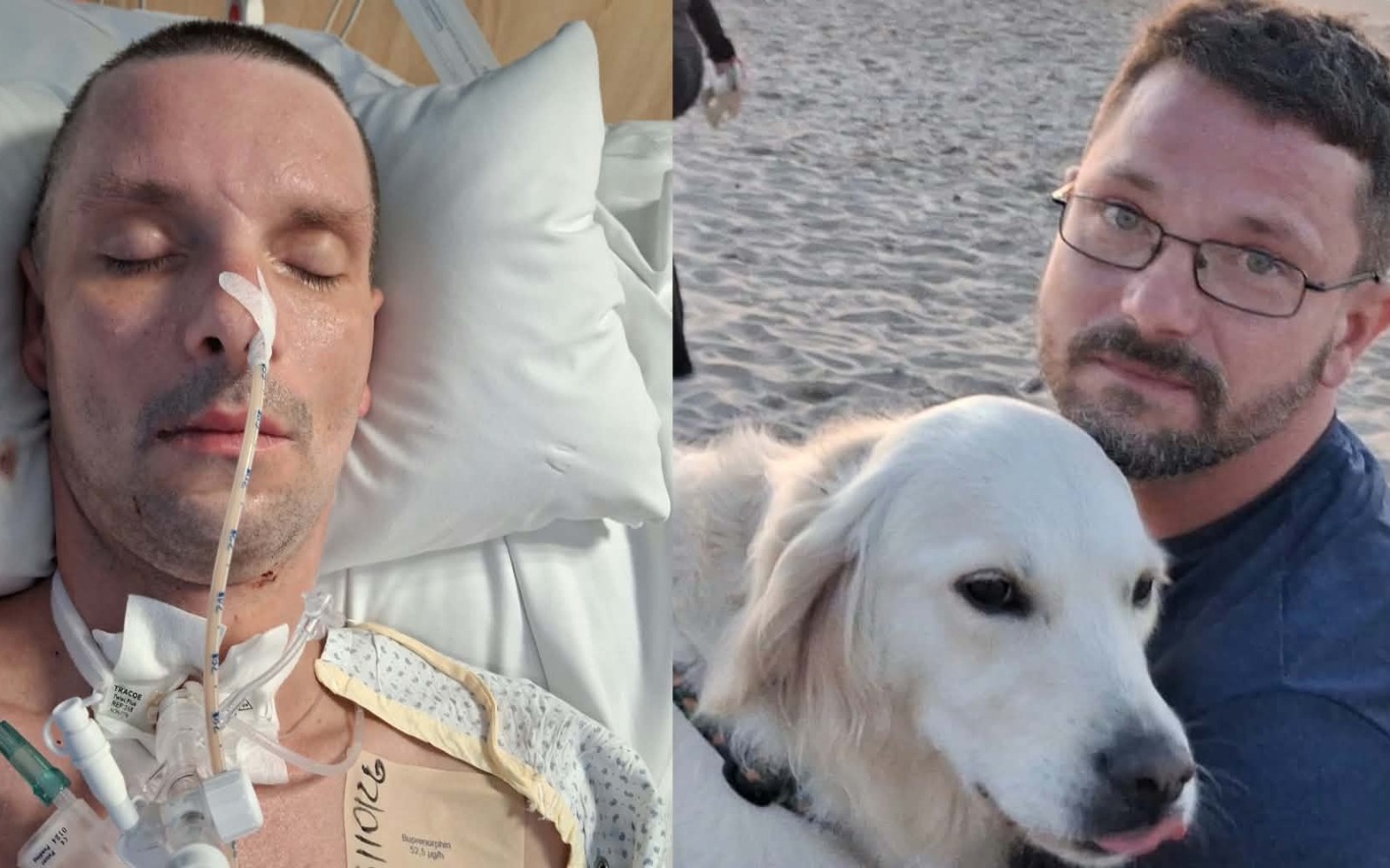 
        Chory mężczyzna na oddziale szpitalnym, podłączony do aparatury
    