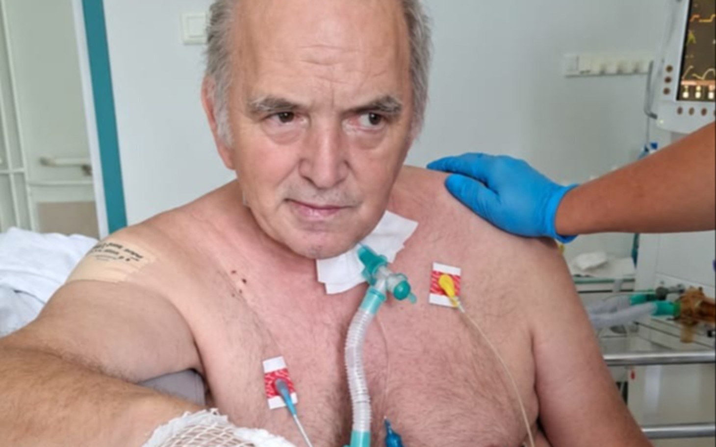 
        Chory starszy mężczyzna w szpitalu, osoba trzyma ramie
    