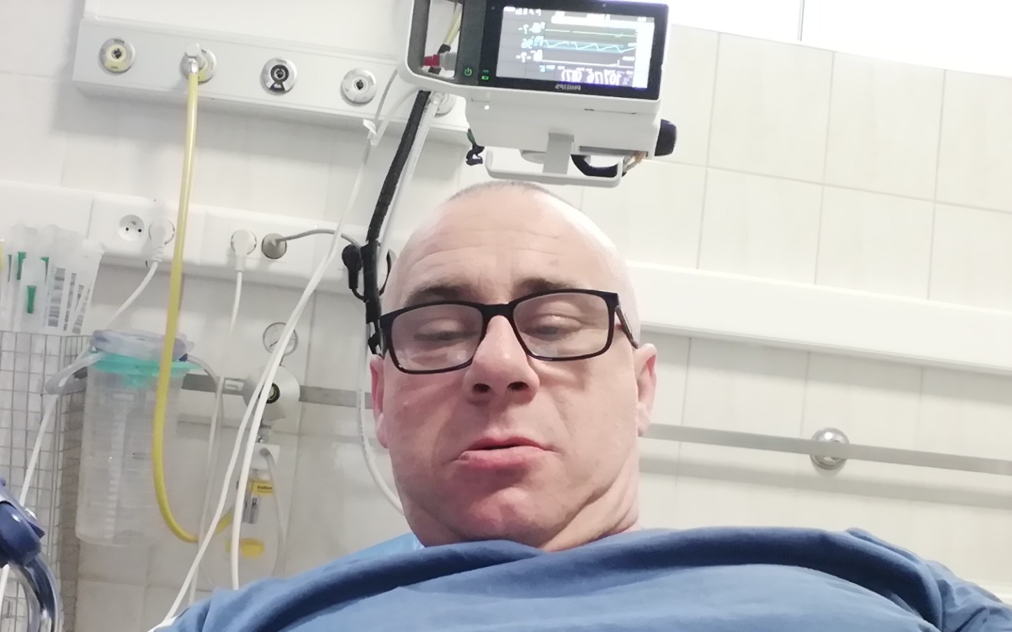 
        Mężczyzna w szpitalu, leżący na łóżku z aparaturą.
    