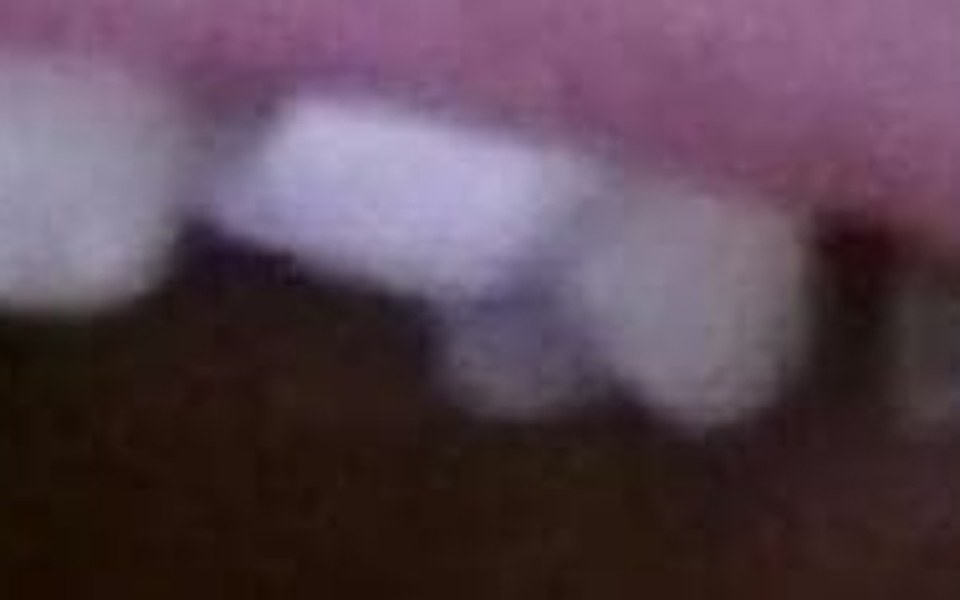 
        Zbiórka Połowa uśmiechu - zdjęcie główne
    