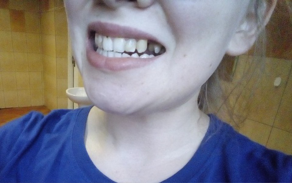 
        Zbiórka Chciałabym uśmiech bez wstydu! - zdjęcie główne
    